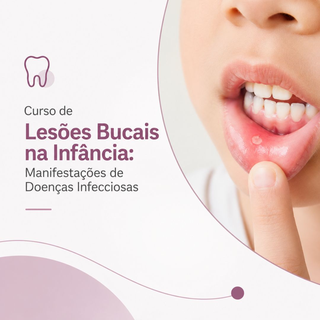 Curso de Lesões Bucais na Infância: Manifestações de Doenças Infecciosas